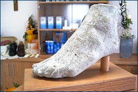 Gipsmodell eines Fußes